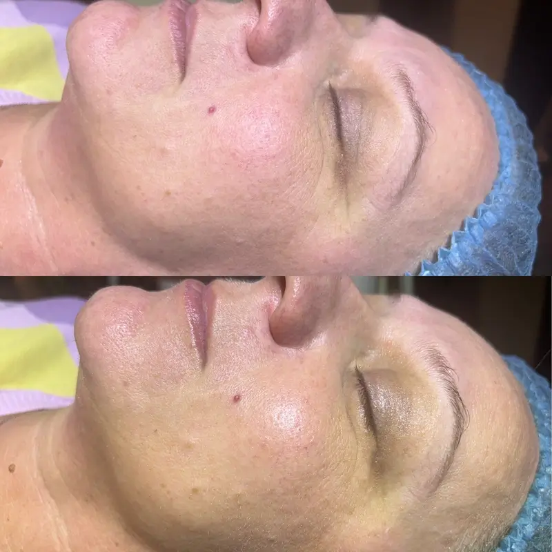 Before-After 12