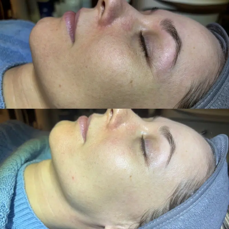 Before-After 16