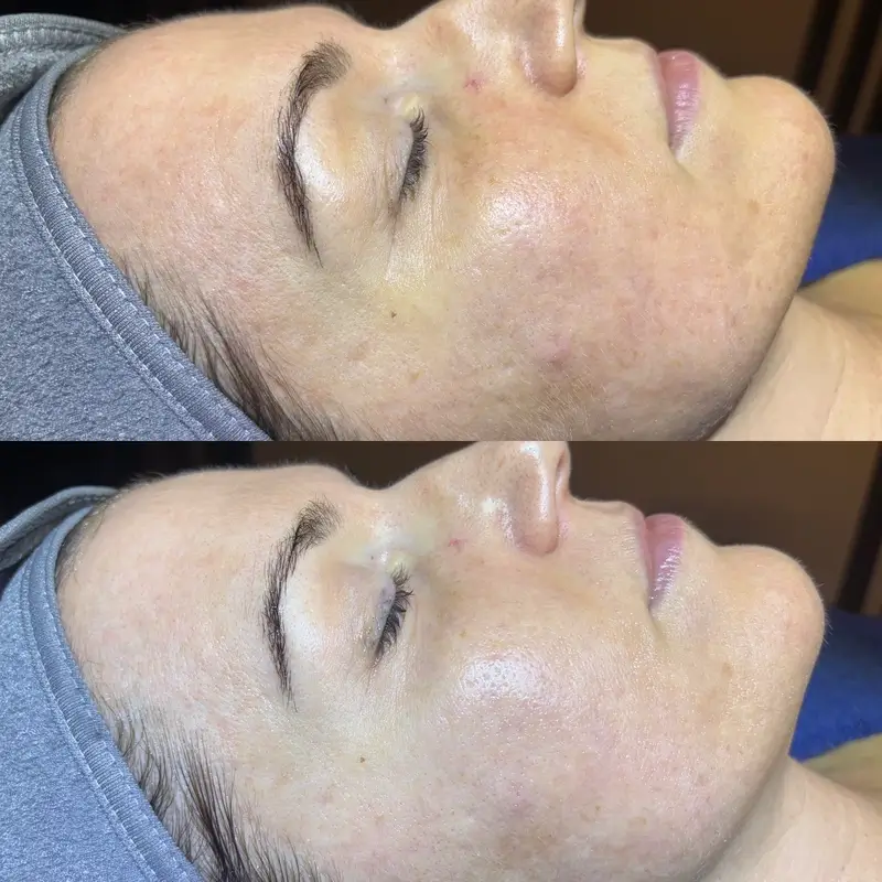Before-After 17