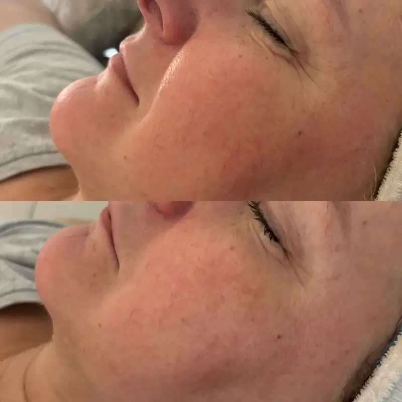 Before-After 3