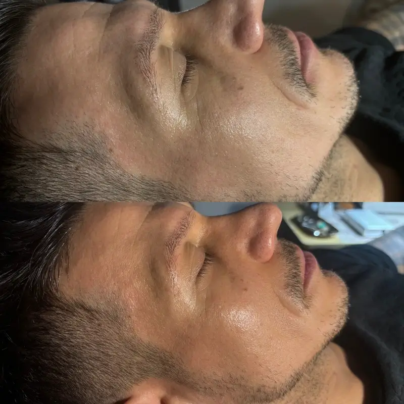 Before-After 4